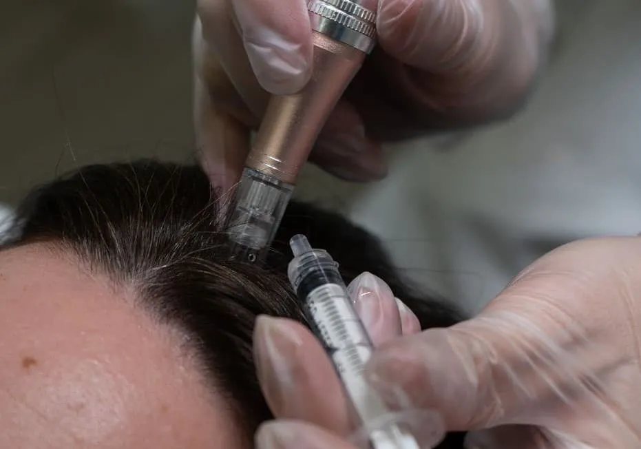 Hair Microneedling